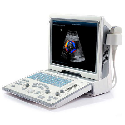 УЗИ аппарат Mindray DP-50 Color