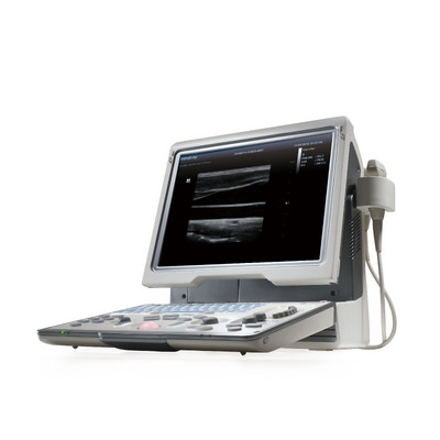 УЗИ аппарат Mindray DP-50 Color