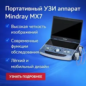 УЗИ аппарат Mindray MX7